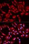 BCL2 Like 13 antibody, LS-C331263, Lifespan Biosciences, Immunofluorescence image 