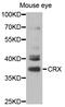 Cone-rod homeobox protein antibody, TA332861, Origene, Western Blot image 