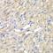 Cysteinyl-TRNA Synthetase antibody, GTX32489, GeneTex, Immunohistochemistry paraffin image 