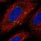 CUB And Sushi Multiple Domains 1 antibody, NBP2-57728, Novus Biologicals, Immunocytochemistry image 