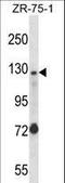 Ubiquitination Factor E4A antibody, LS-C160390, Lifespan Biosciences, Western Blot image 