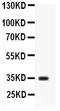 Arginase 1 antibody, RP1075, Boster Biological Technology, Western Blot image 