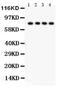 TNF Receptor Superfamily Member 1B antibody, PA5-80158, Invitrogen Antibodies, Western Blot image 