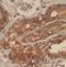 Small Nuclear Ribonucleoprotein Polypeptide F antibody, FNab08077, FineTest, Immunohistochemistry paraffin image 