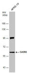 Glutamate Decarboxylase 2 antibody, GTX133096, GeneTex, Western Blot image 