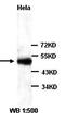 Sp3 Transcription Factor antibody, orb77357, Biorbyt, Western Blot image 