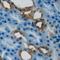 Propionyl-CoA Carboxylase Subunit Beta antibody, LS-B16060, Lifespan Biosciences, Immunohistochemistry frozen image 