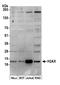 H2A Histone Family Member X antibody, A303-837A, Bethyl Labs, Western Blot image 