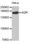 Intron-binding protein of 160 kDa antibody, abx004620, Abbexa, Western Blot image 