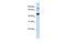 TBC1 Domain Family Member 16 antibody, GTX46999, GeneTex, Western Blot image 