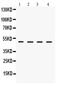 Lecithin-Cholesterol Acyltransferase antibody, PB9657, Boster Biological Technology, Western Blot image 