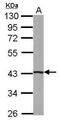 Beta-1,4-Galactosyltransferase 5 antibody, PA5-31092, Invitrogen Antibodies, Western Blot image 