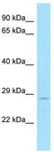 DSN1 Component Of MIS12 Kinetochore Complex antibody, TA338300, Origene, Western Blot image 