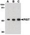 Golgi Associated PDZ And Coiled-Coil Motif Containing antibody, PA5-20179, Invitrogen Antibodies, Western Blot image 