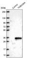 Transmembrane Protein 38A antibody, NBP2-13452, Novus Biologicals, Western Blot image 