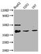 NK2 Homeobox 1 antibody, CSB-RA181189A0HU, Cusabio, Western Blot image 