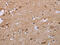 Activin A Receptor Type 2A antibody, CSB-PA104519, Cusabio, Immunohistochemistry paraffin image 