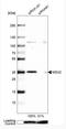 Msh Homeobox 2 antibody, NBP1-85445, Novus Biologicals, Western Blot image 