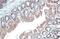 Adenosine Deaminase antibody, GTX101390, GeneTex, Immunohistochemistry paraffin image 