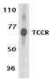 Interleukin-27 receptor subunit alpha antibody, TA306080, Origene, Western Blot image 