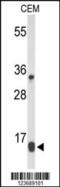 DIRAS Family GTPase 1 antibody, 63-928, ProSci, Western Blot image 