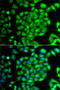 Mesenchyme Homeobox 1 antibody, STJ29471, St John