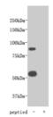 Transmembrane protein 2 antibody, MBS857144, MyBioSource, Western Blot image 