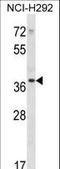 PDZ And LIM Domain 1 antibody, LS-C163496, Lifespan Biosciences, Western Blot image 