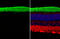 Rhodopsin antibody, GTX129911, GeneTex, Immunohistochemistry paraffin image 