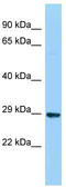 Deoxyribose-Phosphate Aldolase antibody, TA343318, Origene, Western Blot image 
