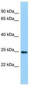 Deoxyribose-Phosphate Aldolase antibody, TA343318, Origene, Western Blot image 