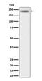 MAP kinase-activating death domain protein antibody, M02030, Boster Biological Technology, Western Blot image 