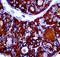 Thyroglobulin antibody, LS-C348608, Lifespan Biosciences, Immunohistochemistry paraffin image 
