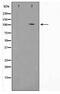 Vav Guanine Nucleotide Exchange Factor 3 antibody, TA348443, Origene, Western Blot image 