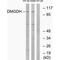 Dimethylglycine Dehydrogenase antibody, PA5-50021, Invitrogen Antibodies, Western Blot image 