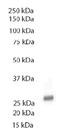 TOLIP antibody, AM08202PU-N, Origene, Western Blot image 