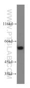 Chaperonin Containing TCP1 Subunit 6A antibody, 19793-1-AP, Proteintech Group, Western Blot image 