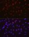 Aurora Kinase B antibody, GTX00916, GeneTex, Immunofluorescence image 