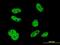 ELAV Like RNA Binding Protein 1 antibody, orb89585, Biorbyt, Immunocytochemistry image 