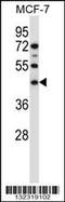 Sphingomyelin Synthase 1 antibody, 57-124, ProSci, Western Blot image 