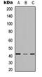 Stearoyl-CoA Desaturase antibody, orb234961, Biorbyt, Western Blot image 