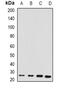 Retinol Binding Protein 4 antibody, abx142191, Abbexa, Western Blot image 