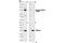 ALK Receptor Tyrosine Kinase antibody, 3341L, Cell Signaling Technology, Western Blot image 