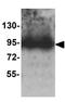 Trophinin antibody, GTX32161, GeneTex, Western Blot image 