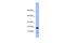 Peptidylprolyl Cis/Trans Isomerase, NIMA-Interacting 4 antibody, A05181, Boster Biological Technology, Western Blot image 