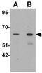 Growth Factor Receptor Bound Protein 10 antibody, GTX31469, GeneTex, Western Blot image 