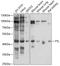 Tubulin Tyrosine Ligase antibody, 13-384, ProSci, Western Blot image 