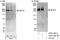 Microtubule Associated Serine/Threonine Kinase 2 antibody, A302-189A, Bethyl Labs, Immunoprecipitation image 