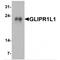 GLIPR1 Like 1 antibody, MBS153361, MyBioSource, Western Blot image 