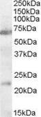 Cholinergic Receptor Nicotinic Alpha 4 Subunit antibody, GTX31078, GeneTex, Western Blot image 